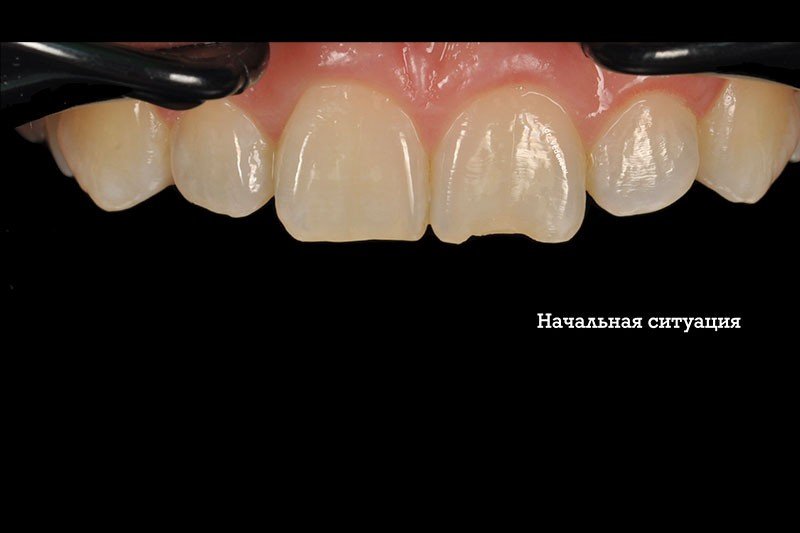 skol_zuba1 skol_zuba1